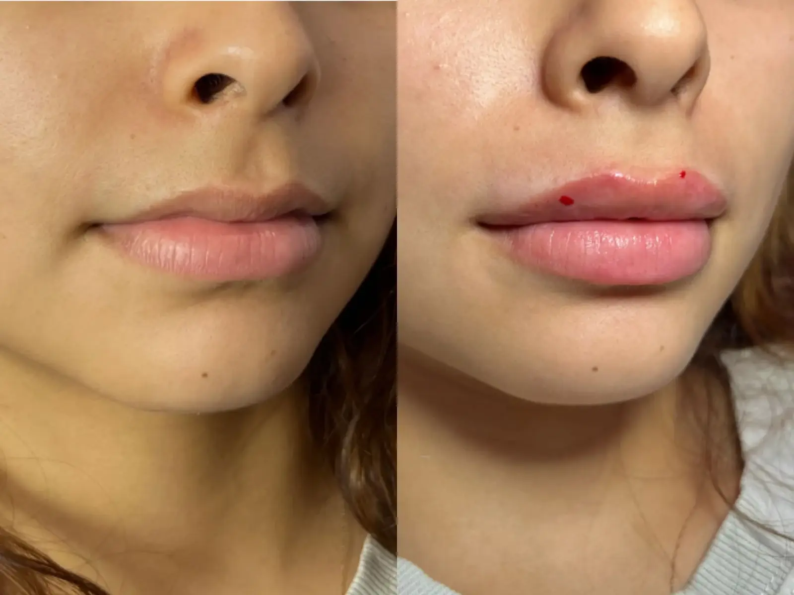 Two close views of the mouth with the chin turned slightly away